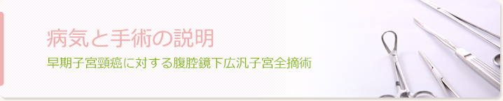 早期子宮頸癌に対する腹腔鏡下広汎子宮全摘術